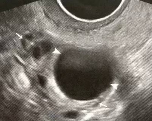 珠海助孕机构：男的精子弱可以做试管婴儿吗,怎样调理男性弱精