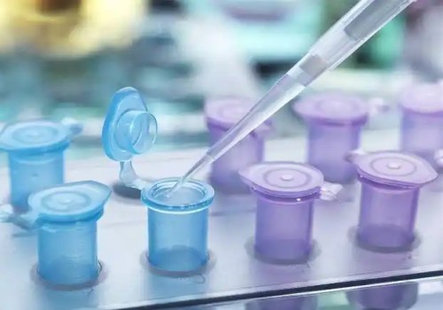 珠海助孕生子：脐血检查染色体检查什么，脐血检查染色体疼吗