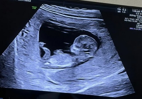 珠海试管助孕价格：2023新余妇幼保健院试管婴儿全方位指南，费用明细及成功率参考