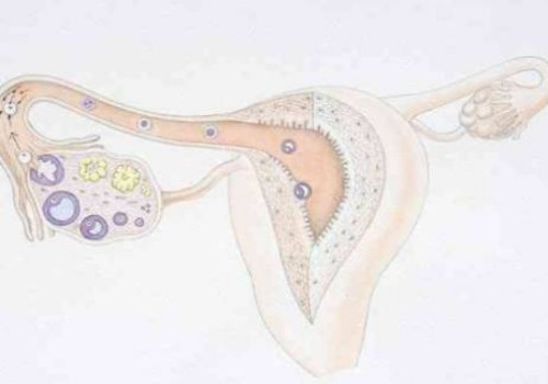 珠海试管婴儿价格：孕晚期女性缓解宫缩的方法有哪些？