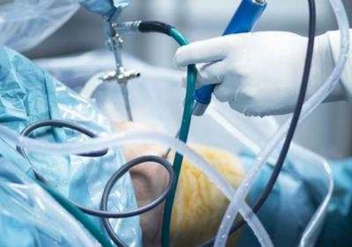 珠海供卵试管：改变生活习惯，治疗不排卵不再难！