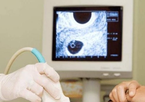 卵泡还没有成熟就已经排出了有什么办法可以解决吗？