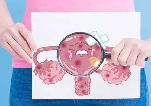 怀二胎检查要做什么,怀二胎什么时候去检查