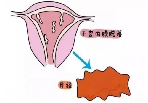 雷特综合症怀孕期间能检查出来吗？雷特综合症这些症状早知道早预防